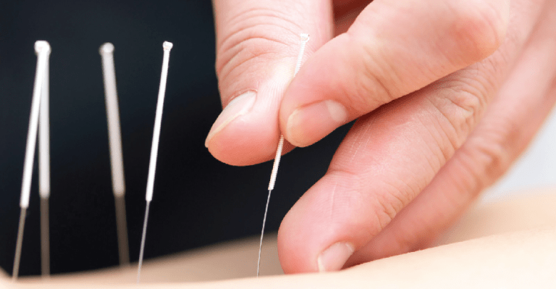 Bệnh nhân đột quỵ châm cứu, bấm huyệt được không?