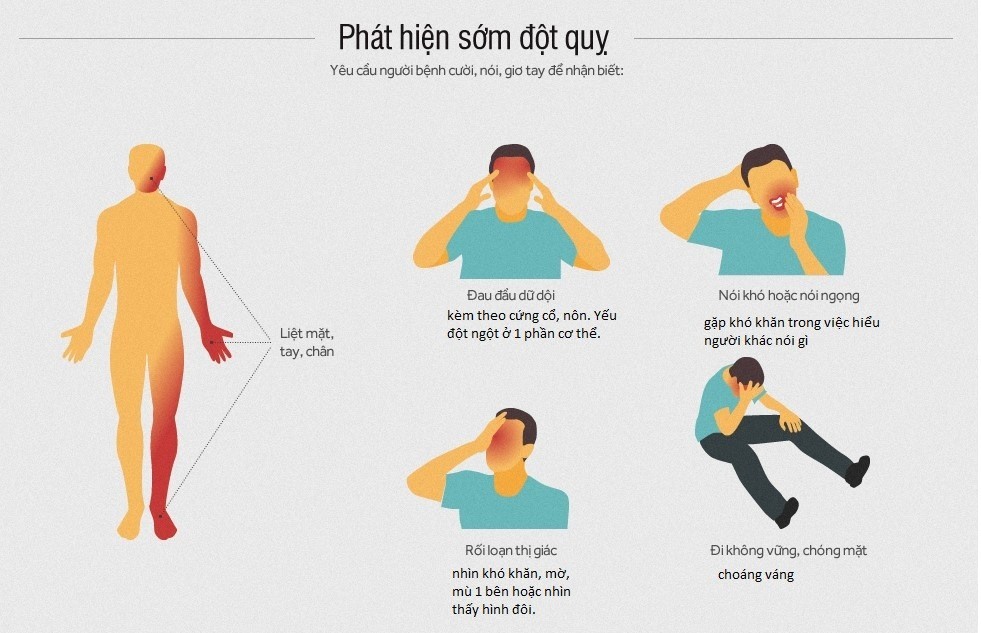 Dấu hiệu cảnh báo đột quỵ, bạn nên biết!