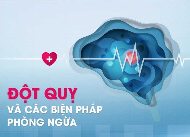 Đột quỵ phòng ngừa được không?