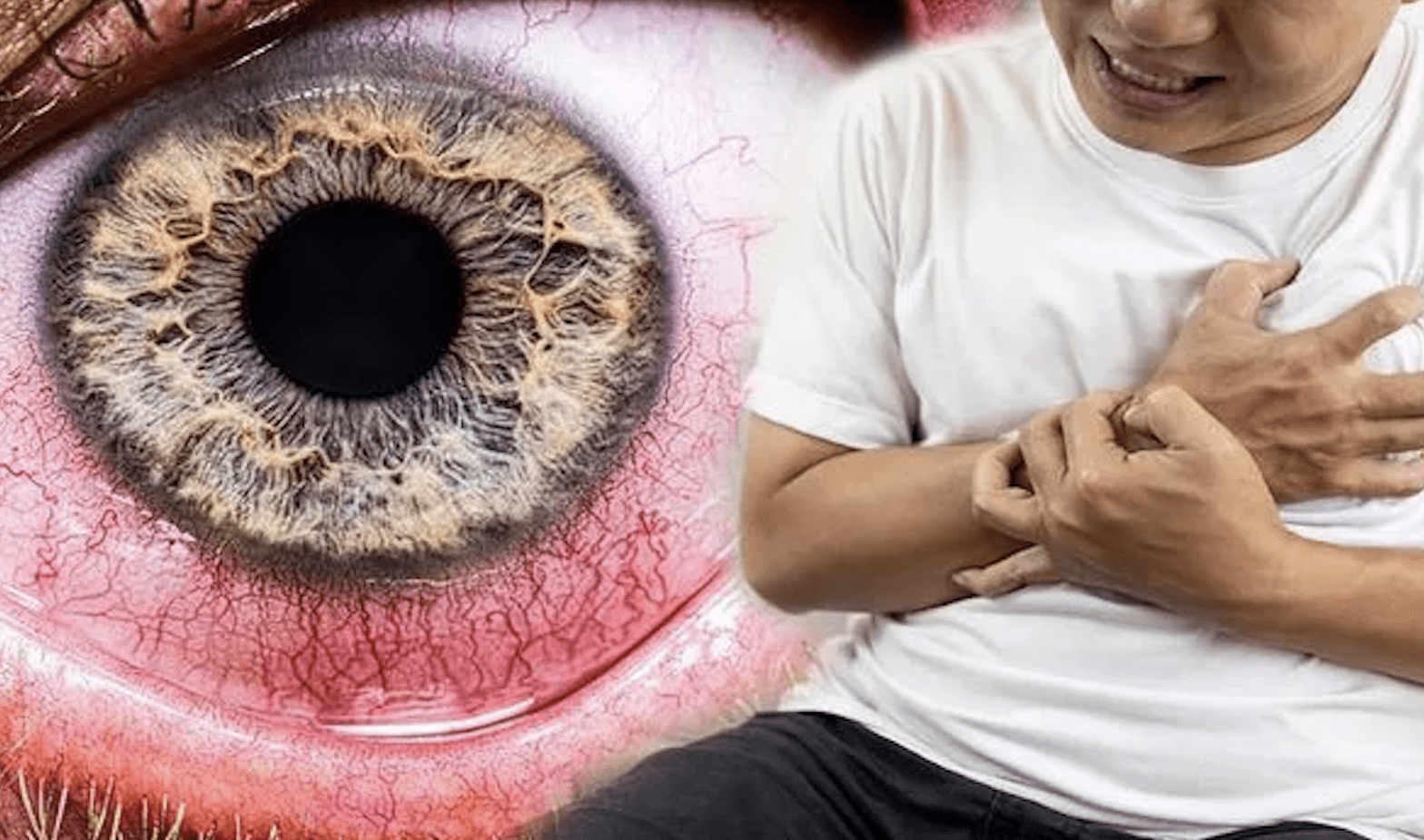 3 dấu hiệu bất thường ở mắt cảnh báo mức độ cholesterol cao nguy hiểm