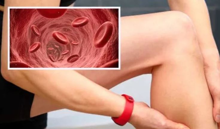 3 dấu hiệu cục máu đông có thể đang ở chân của bạn