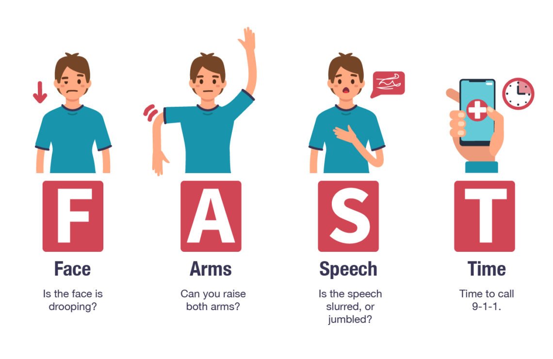 Làm thế nào để biết ai đó đang bị đột quỵ?