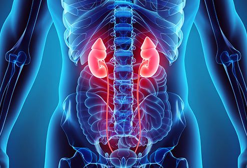 huyết khối ở thận