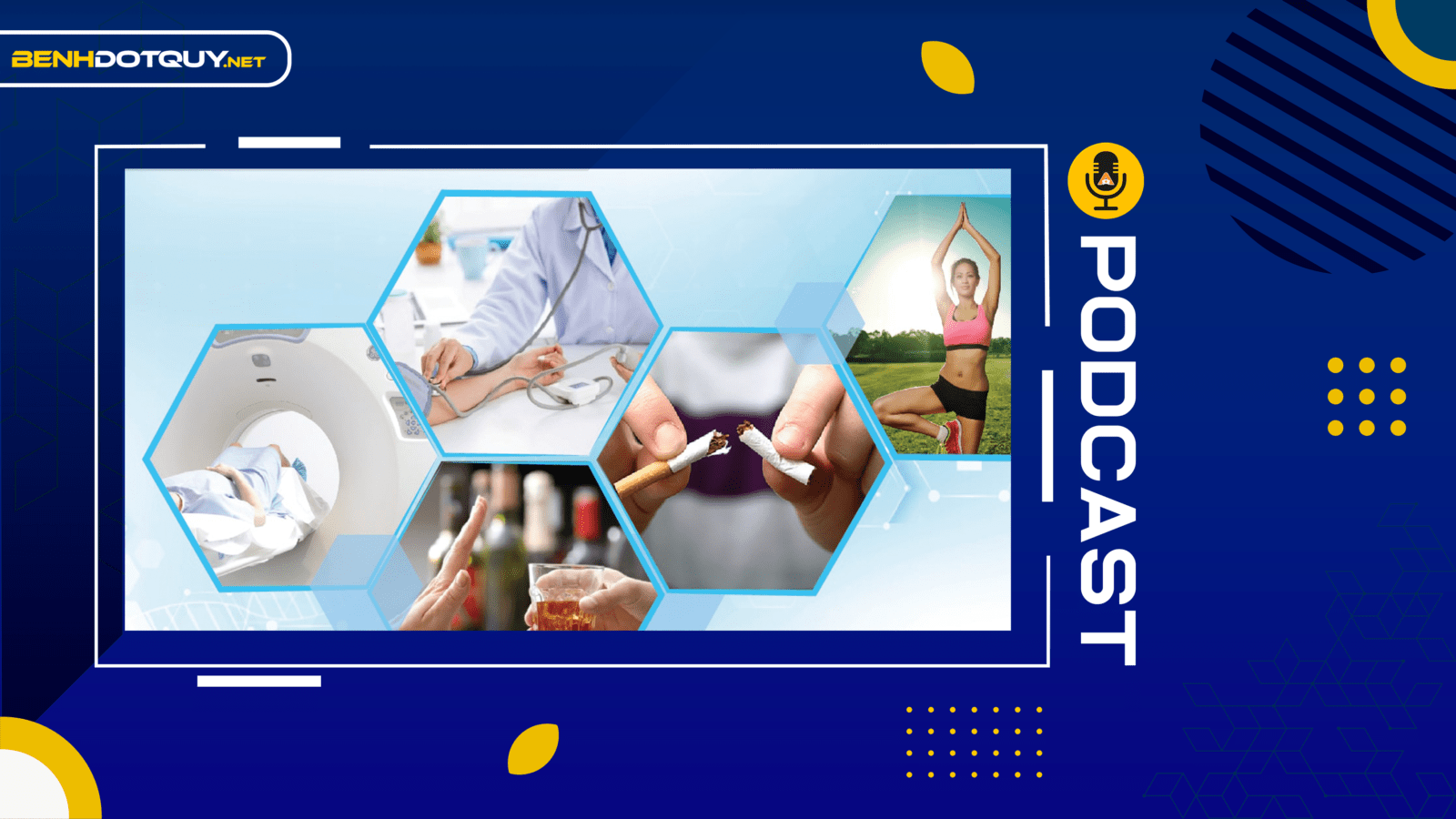 90% ca đột quỵ có thể phòng ngừa