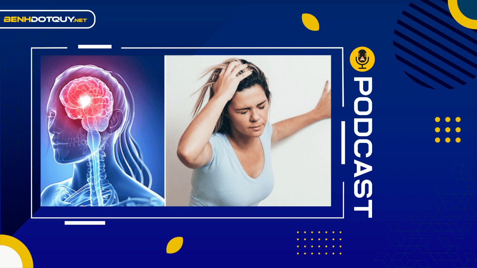 Ai dễ là ‘mồi ngon’ của đột quỵ?