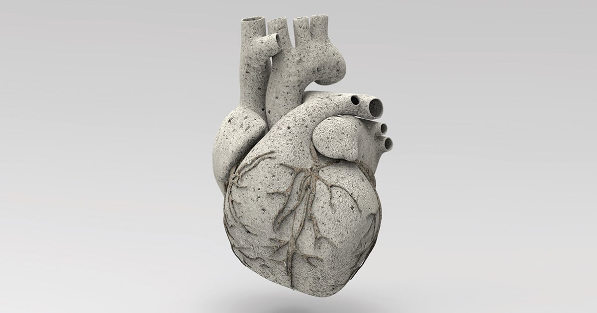 Xạ trị làm tăng nguy cơ đau tim ở bệnh nhân ung thư phổi