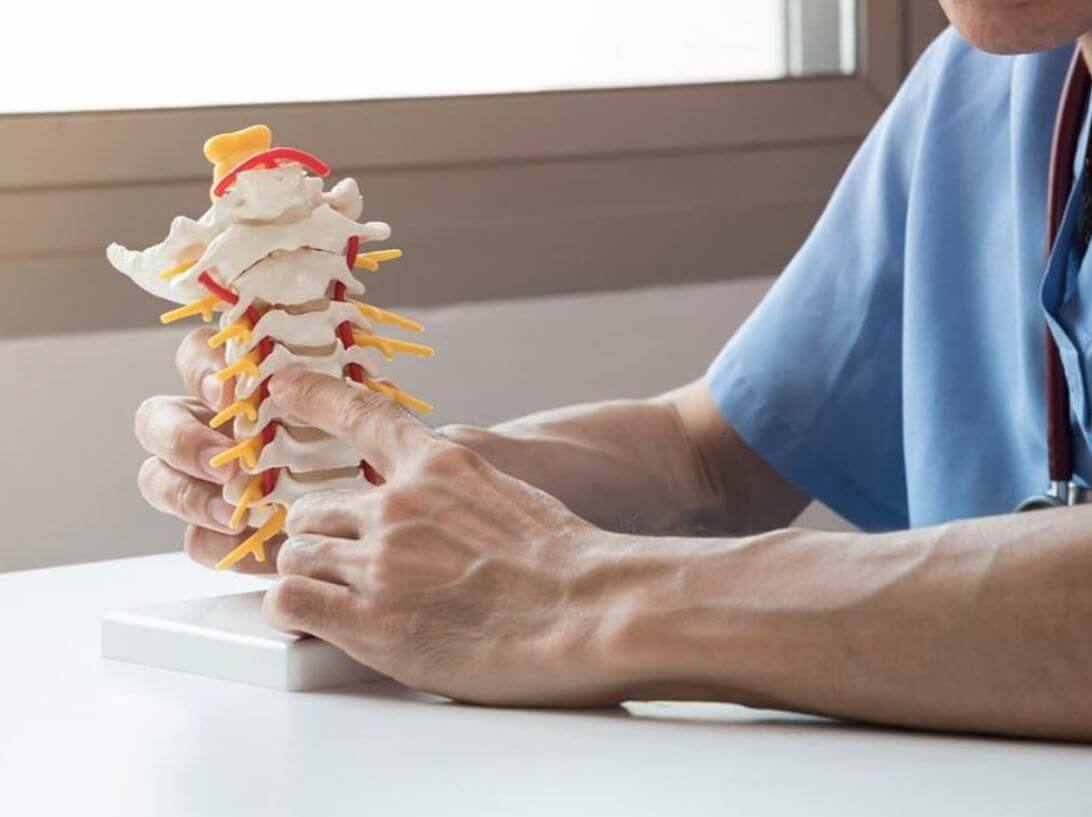 Đột quỵ cột sống: Triệu chứng, chẩn đoán và cách điều trị