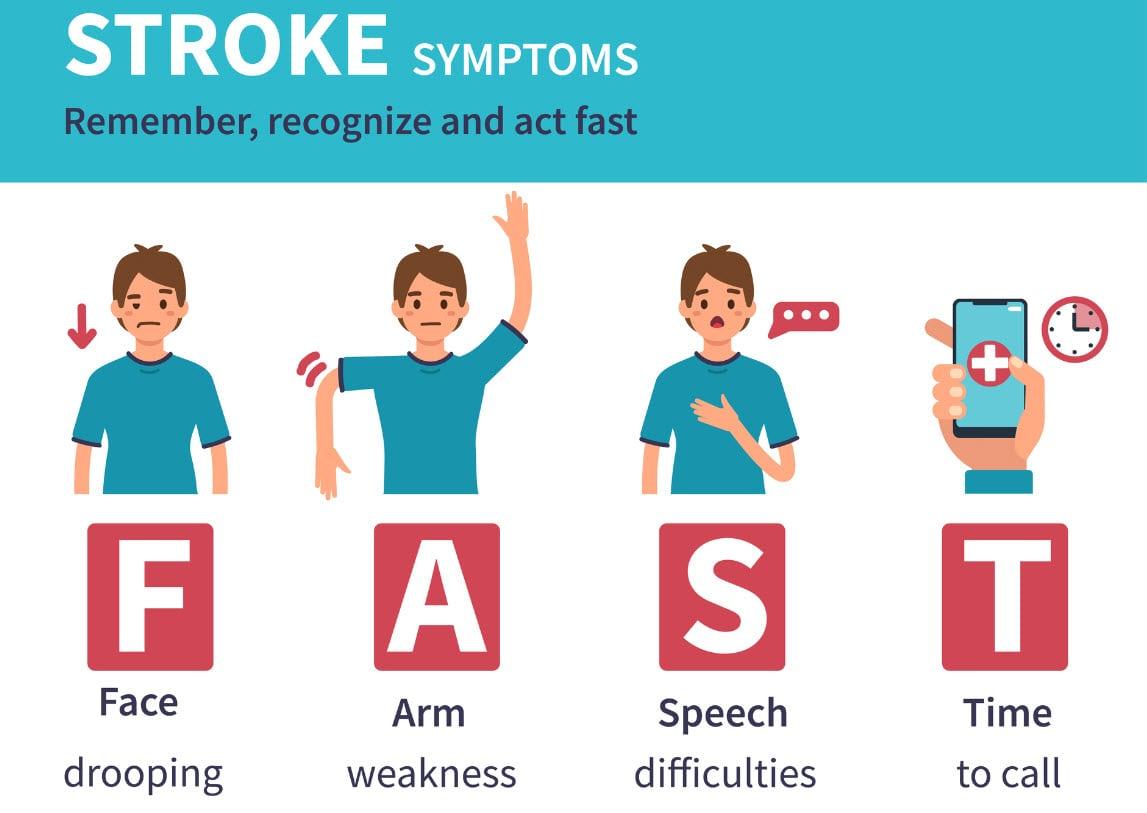 Chúng ta có thể phát hiện một đứa trẻ bị đột quỵ thông qua quy tắc F.A.S.T.