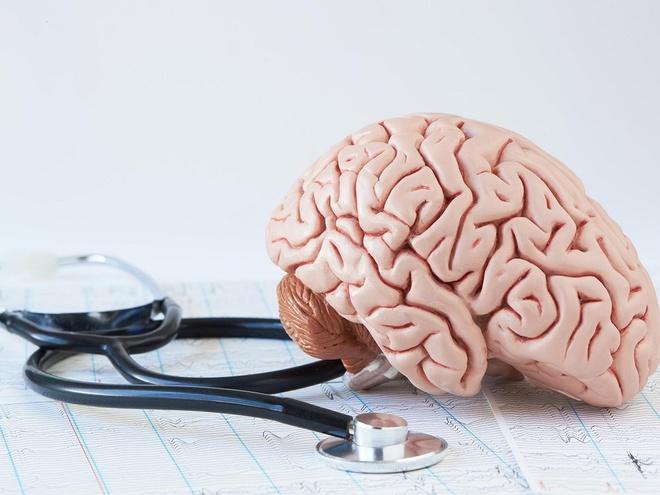 Điều gì xảy ra nếu bác sĩ chẩn đoán sai đột quỵ?