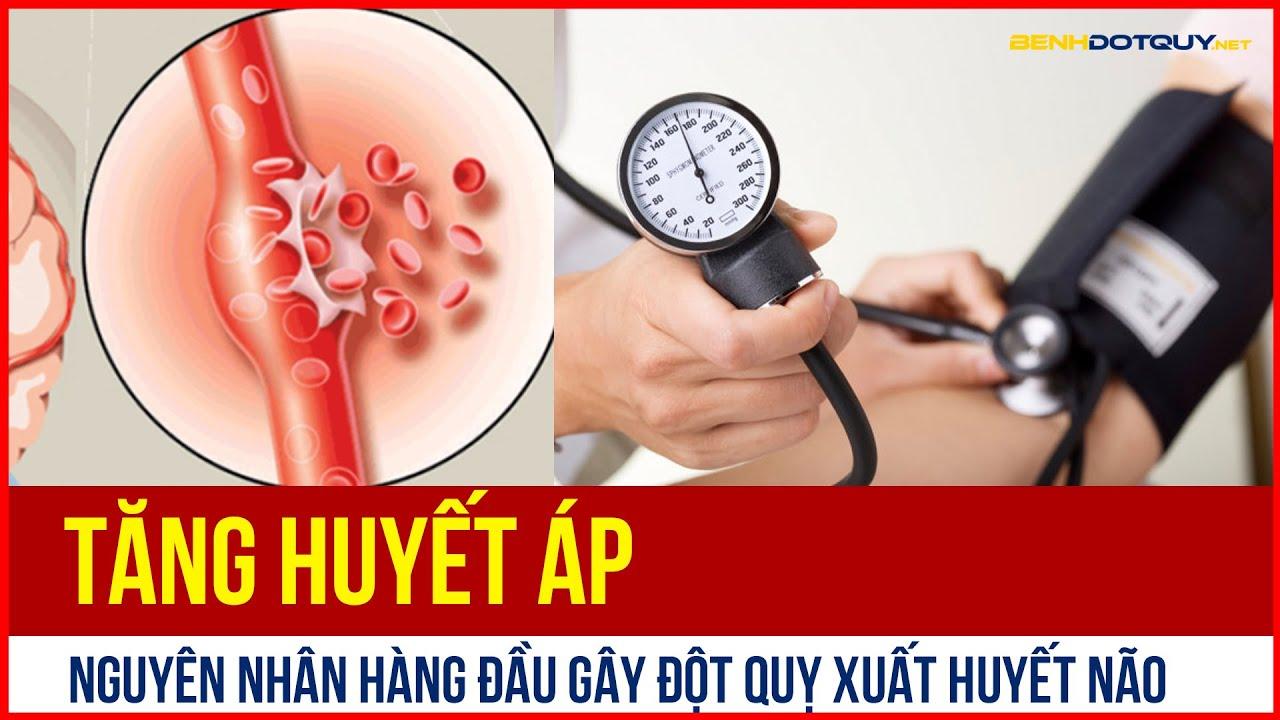 Tăng huyết áp – Nguyên nhân hàng đầu gây đột quỵ xuất huyết não