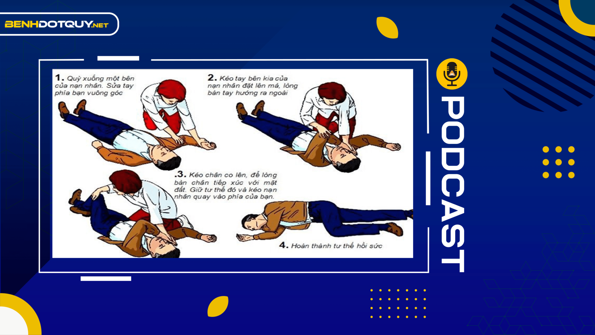 Việc cần làm ngay khi gặp bệnh nhân đột quỵ