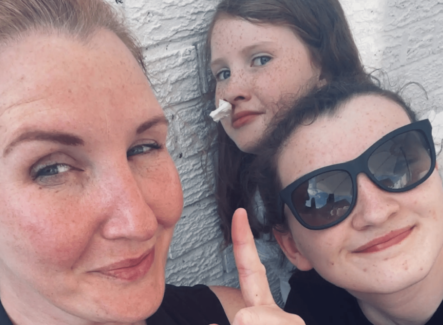 Sau 30 năm chảy máu cam liên tục, một người phụ nữ phát hiện mình mắc căn bệnh di truyền hiếm gặp