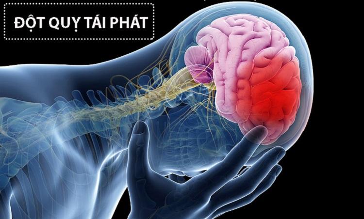 Làm thế nào để ngăn ngừa đột quỵ lần 2