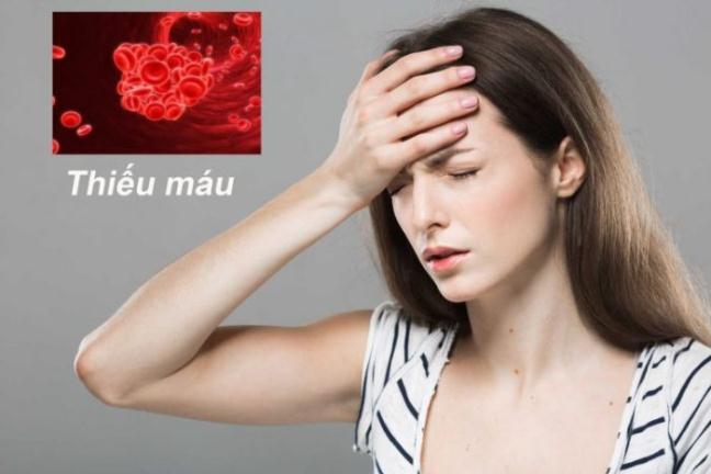Thiếu máu có thể làm tăng nguy cơ tử vong sau đột quỵ