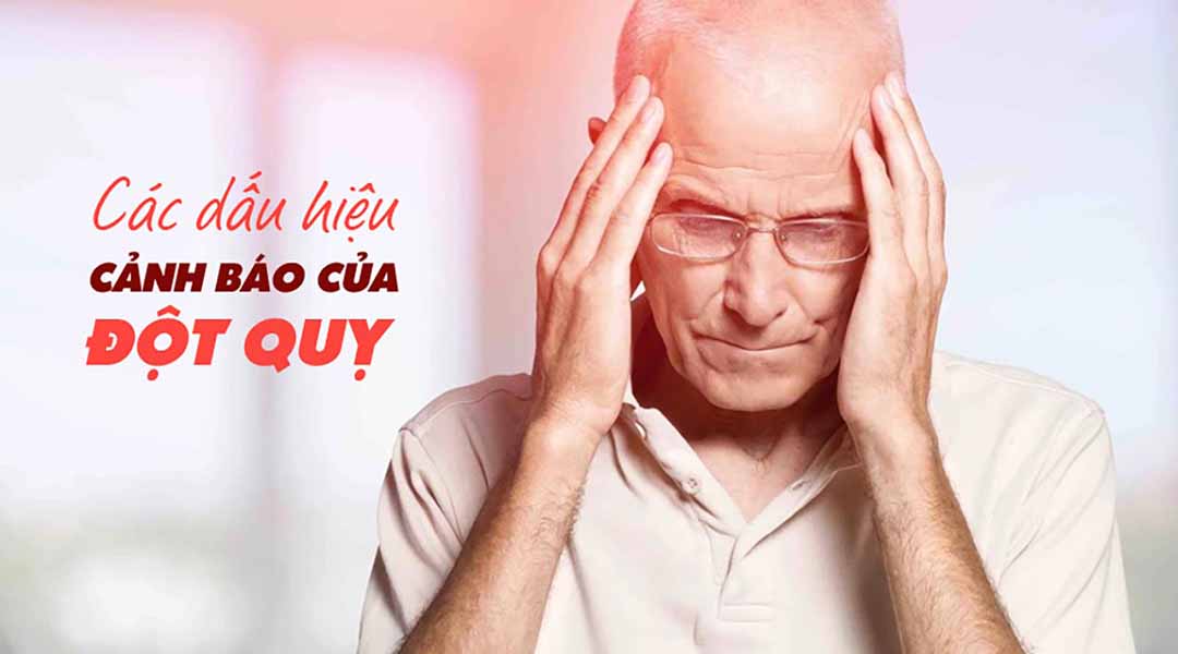Bạn có biết các dấu hiệu của đột quỵ?