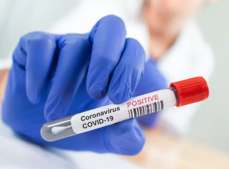 Đột quỵ liên quan đến COVID-19 có tỷ lệ tử vong cao