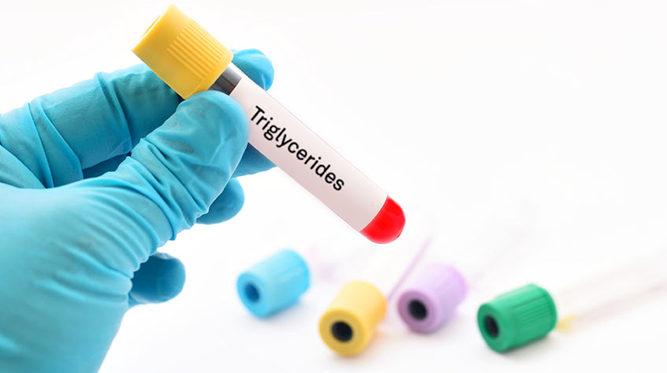 Người có mức chất béo trung tính cao nguy cơ tử vong hoặc đột quỵ lên đến 21%