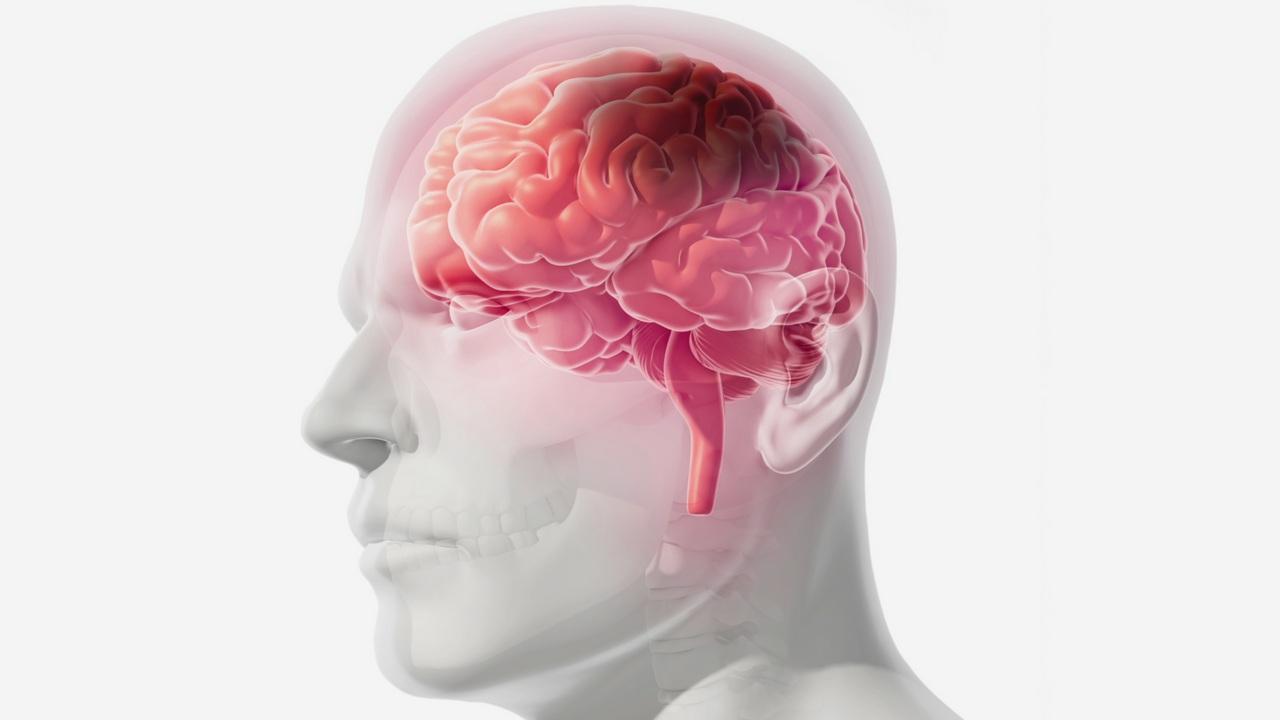 Các yếu tố nguy cơ của cơn thiếu máu não thoáng qua cũng tương tự như đột quỵ thiếu máu cục bộ