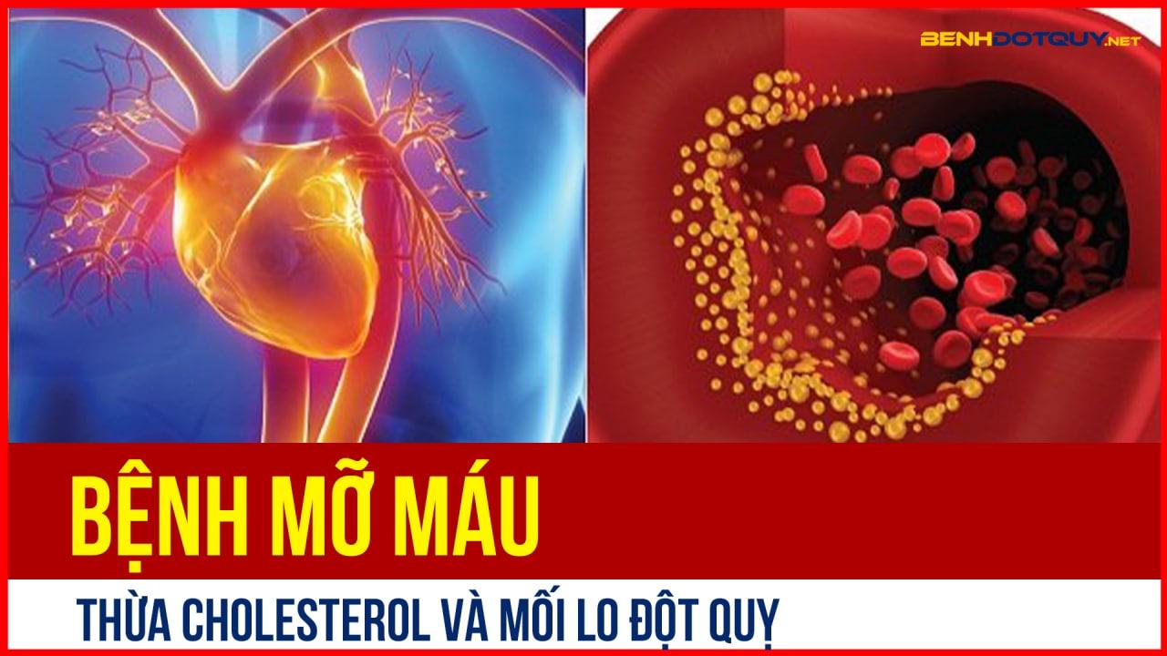 Thừa Cholesterol và mối lo đột quỵ