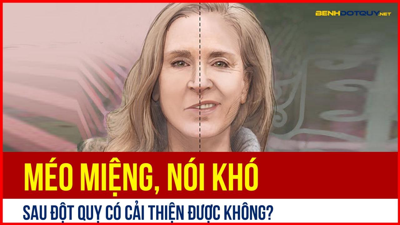 Méo miệng, nói khó sau đột quỵ có cải thiện được không?