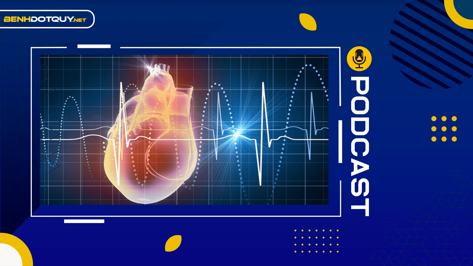 Nhận biết sớm rung nhĩ, dự phòng đột quỵ và các biến chứng liên quan