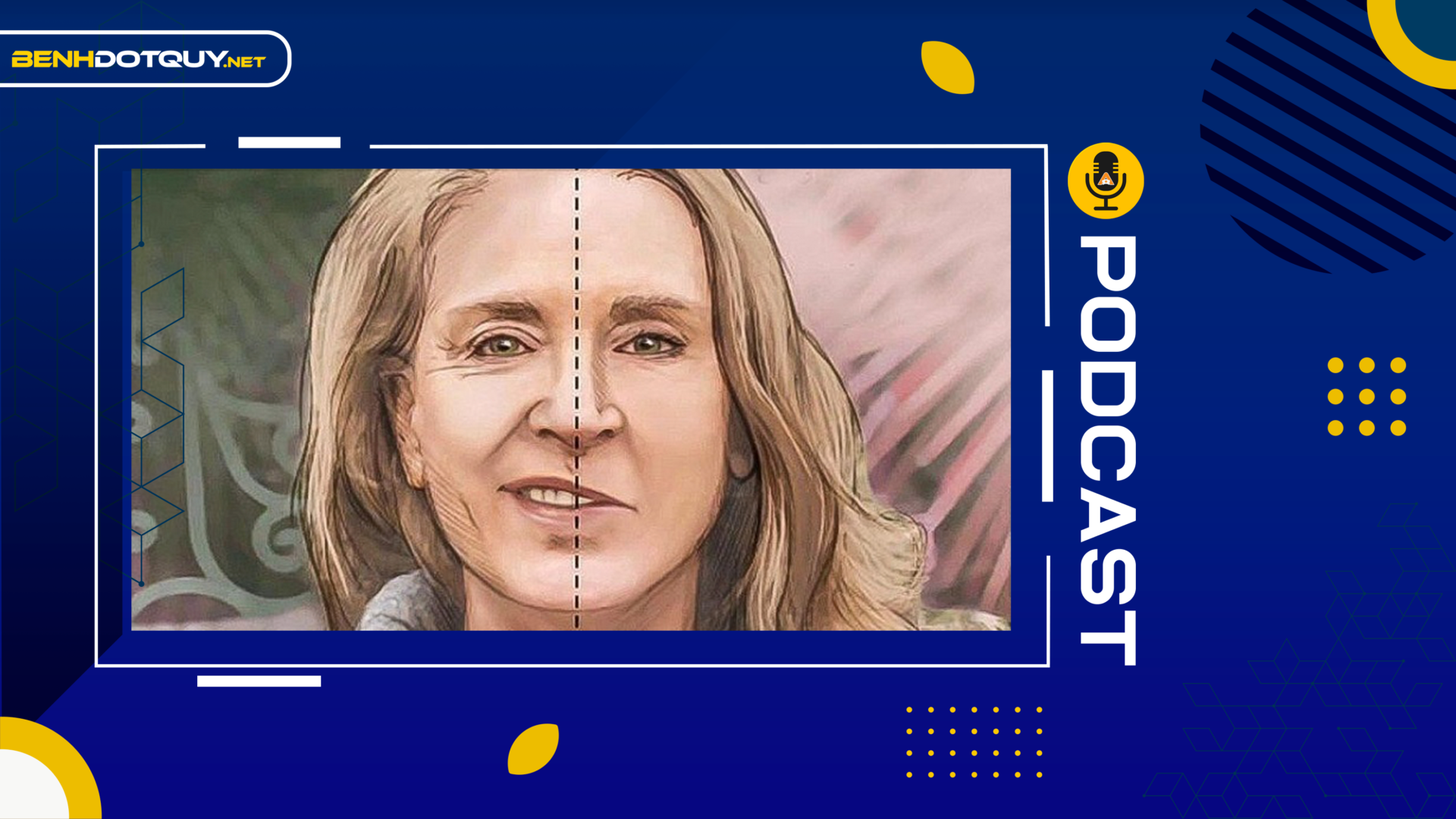 Cách phát hiện người bị đột quỵ qua nụ cười