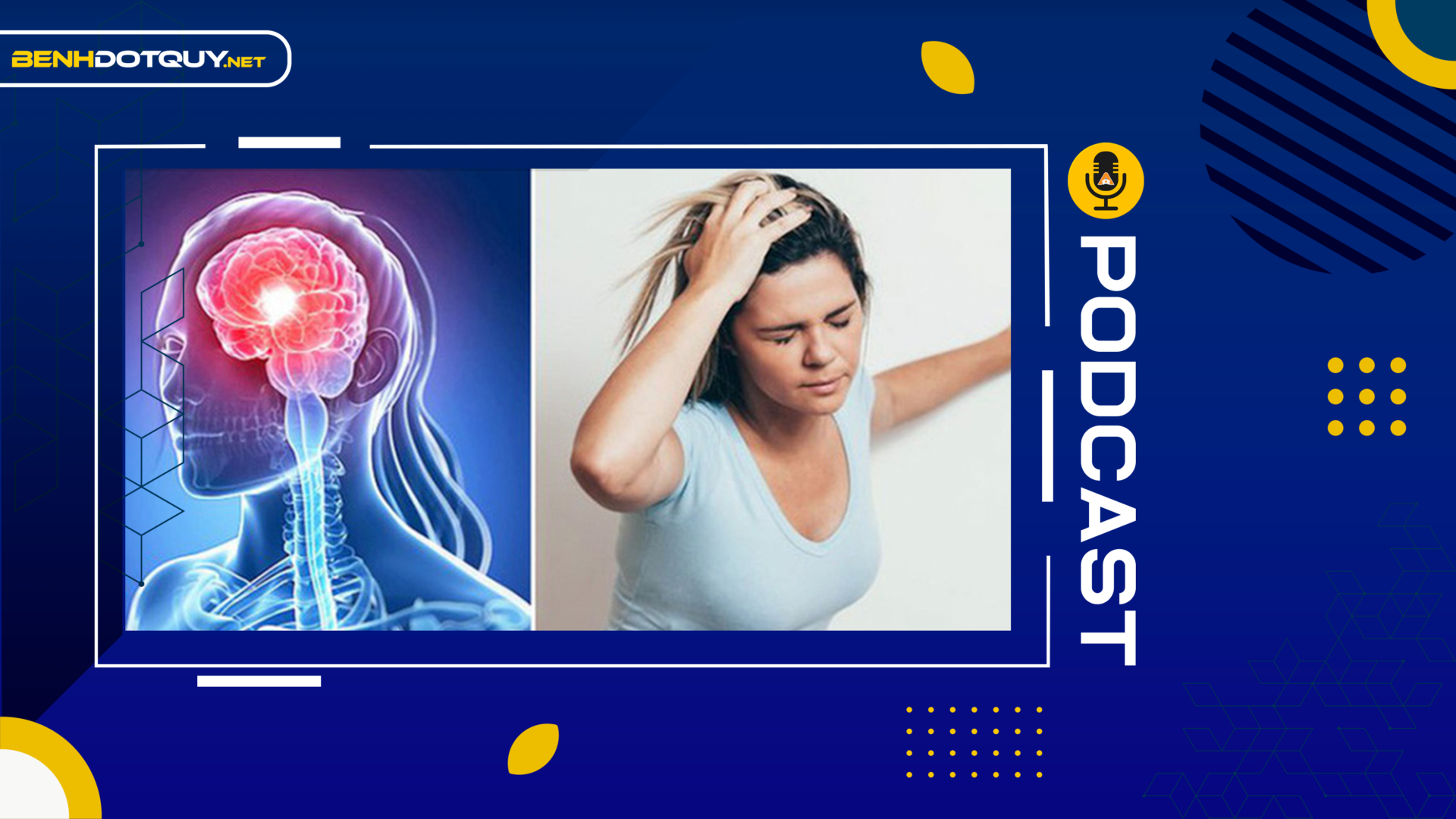 Những thời điểm dễ bị đột quỵ não