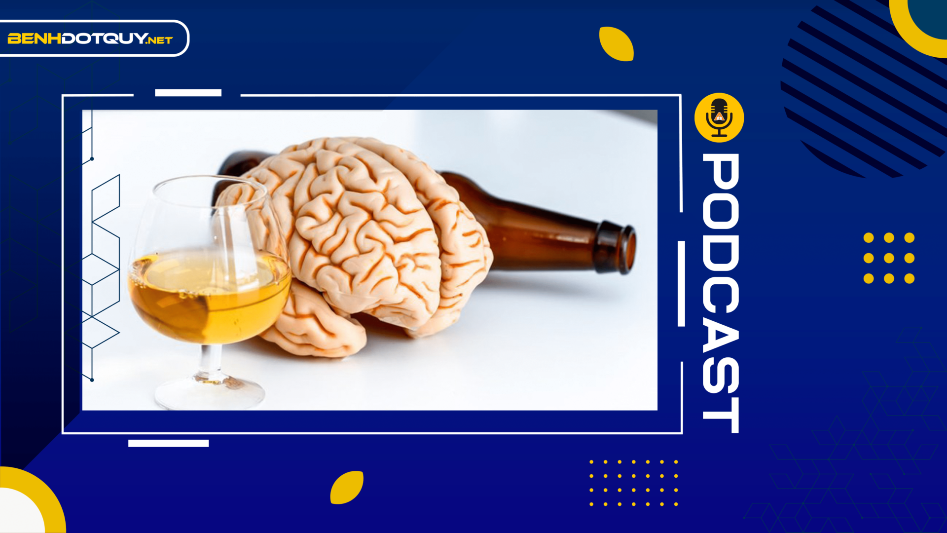 Ham rượu bia, thuốc lá, người trẻ dễ đột quỵ não