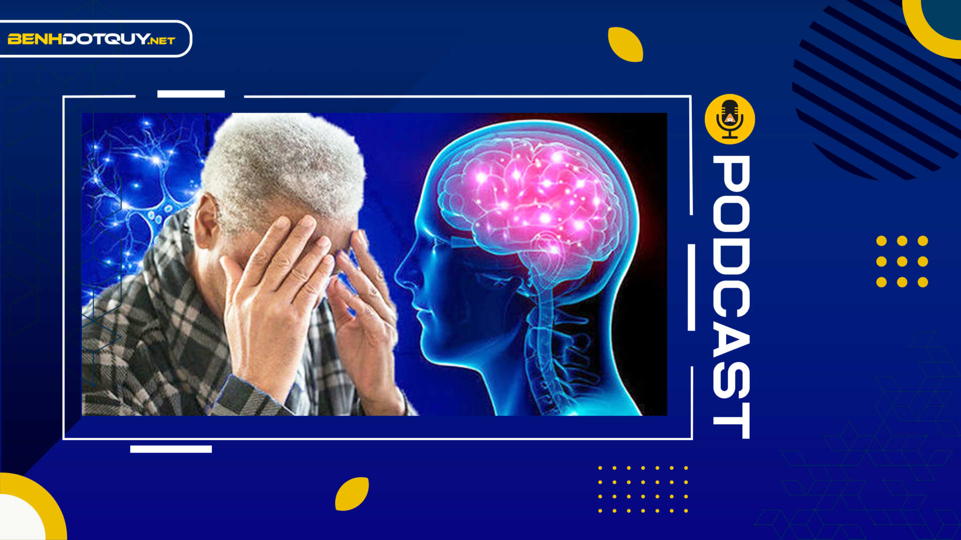 5 dấu hiệu cho thấy bạn đang có một cơn đột quỵ não