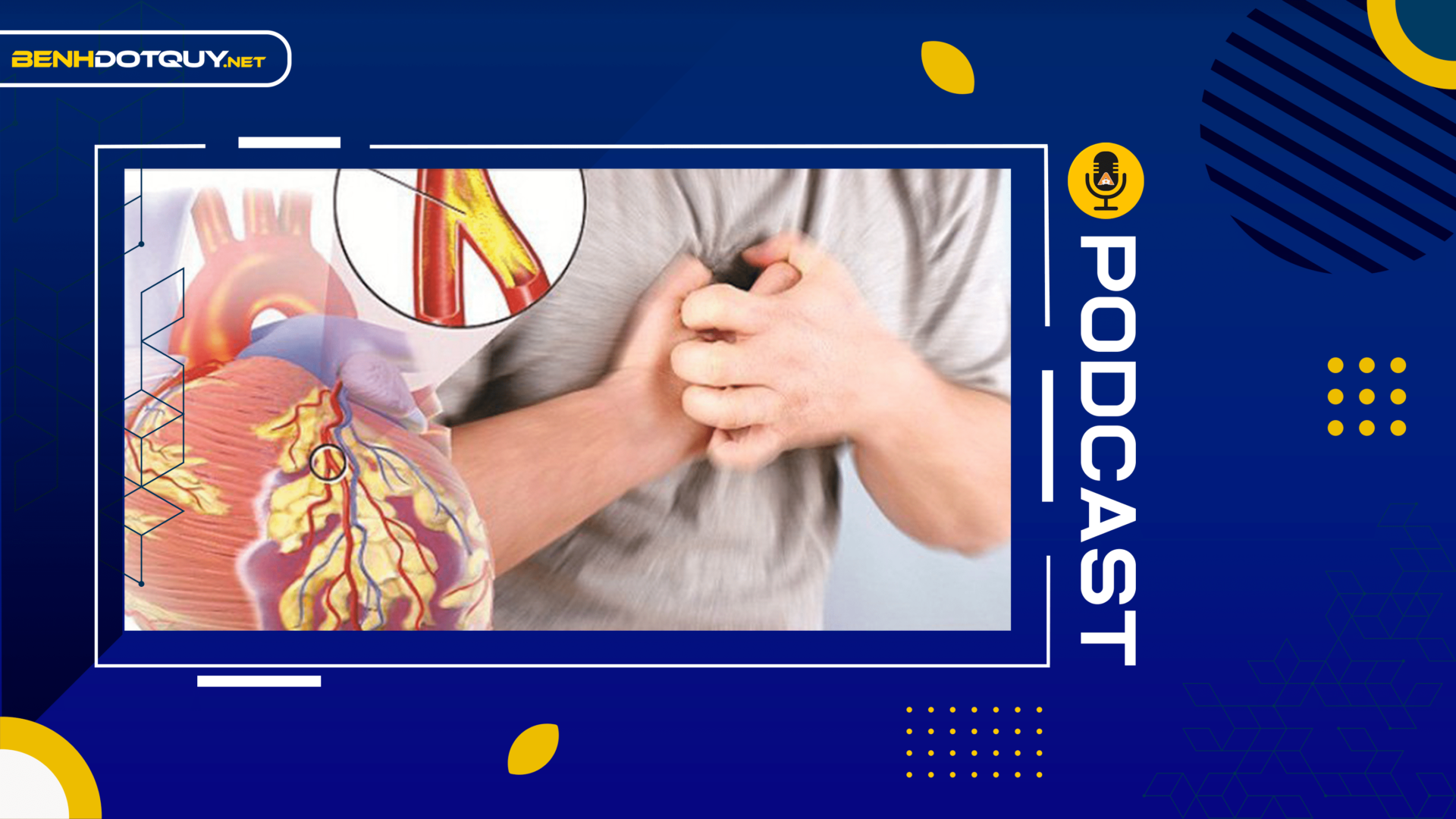 Đối tượng nào dễ mắc bệnh tim thiếu máu cục bộ?