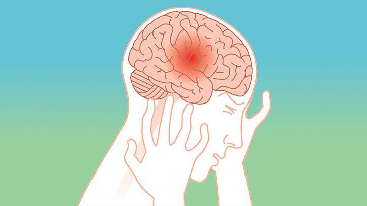 Rối loạn căng thẳng sau sang chấn (PTSD) khiến người trẻ có nguy cơ bị đột quỵ