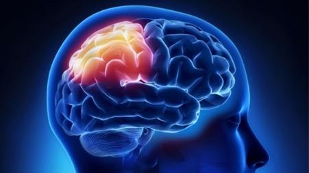 Đột quỵ thùy đỉnh nguy hiểm như thế nào?