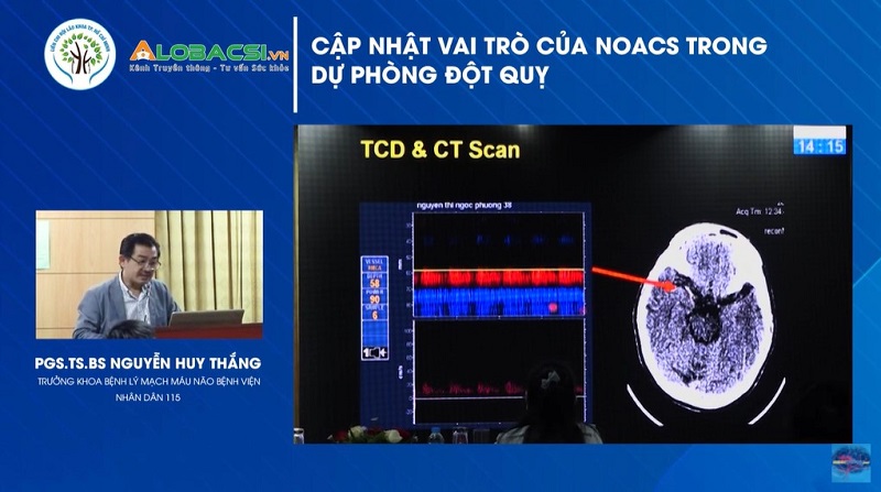 Vai trò của thuốc kháng đông NOACs trong dự phòng đột quỵ