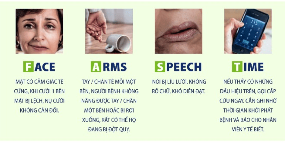 FAST - cách nhận diện dễ dàng một ai đó đang bị đột quỵ.