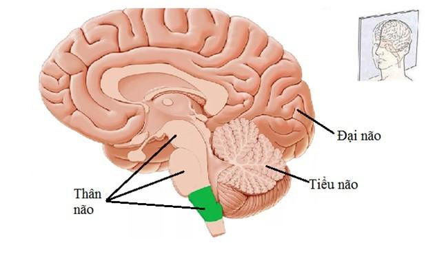 Đột quỵ thân não: Các triệu chứng và khả năng hồi phục