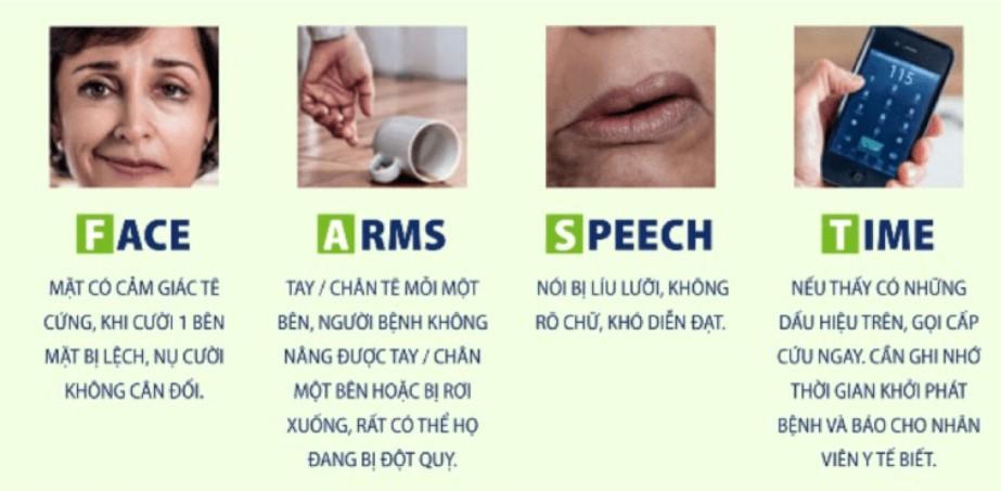 Dùng từ viết tắt "FAST" dễ nhớ các dấu hiệu cảnh báo đột quỵ, cũng như nhấn mạnh sự cần thiết của hành động nhanh chóng.