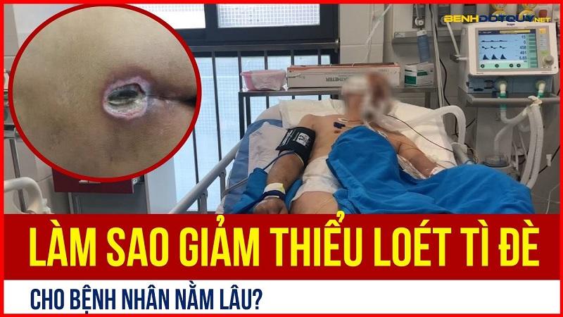 Bệnh nhân nằm lâu giảm thiểu loét tì đè bằng cách nào?