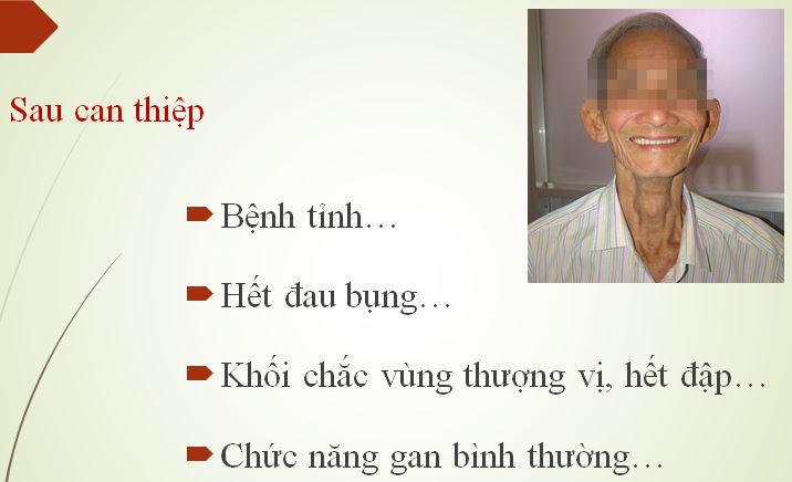 Bệnh nhân hết đau bụng, chức năng gan bình thường và tránh được ca phẫu thuật gan ở độ tuổi 75.