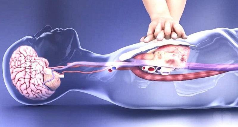 Đối tượng và cách xử trí cấp cứu khi bị ngưng tim đột ngột?