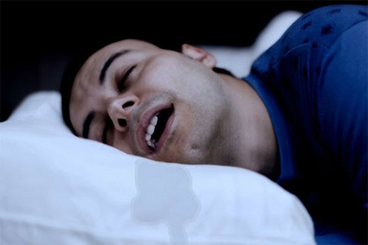 Tình trạng thiếu máu não và thiếu oxy do đột quỵ sẽ ảnh hưởng đến các vùng vỏ não, dẫn đến rối loạn chức năng dưới lưỡi