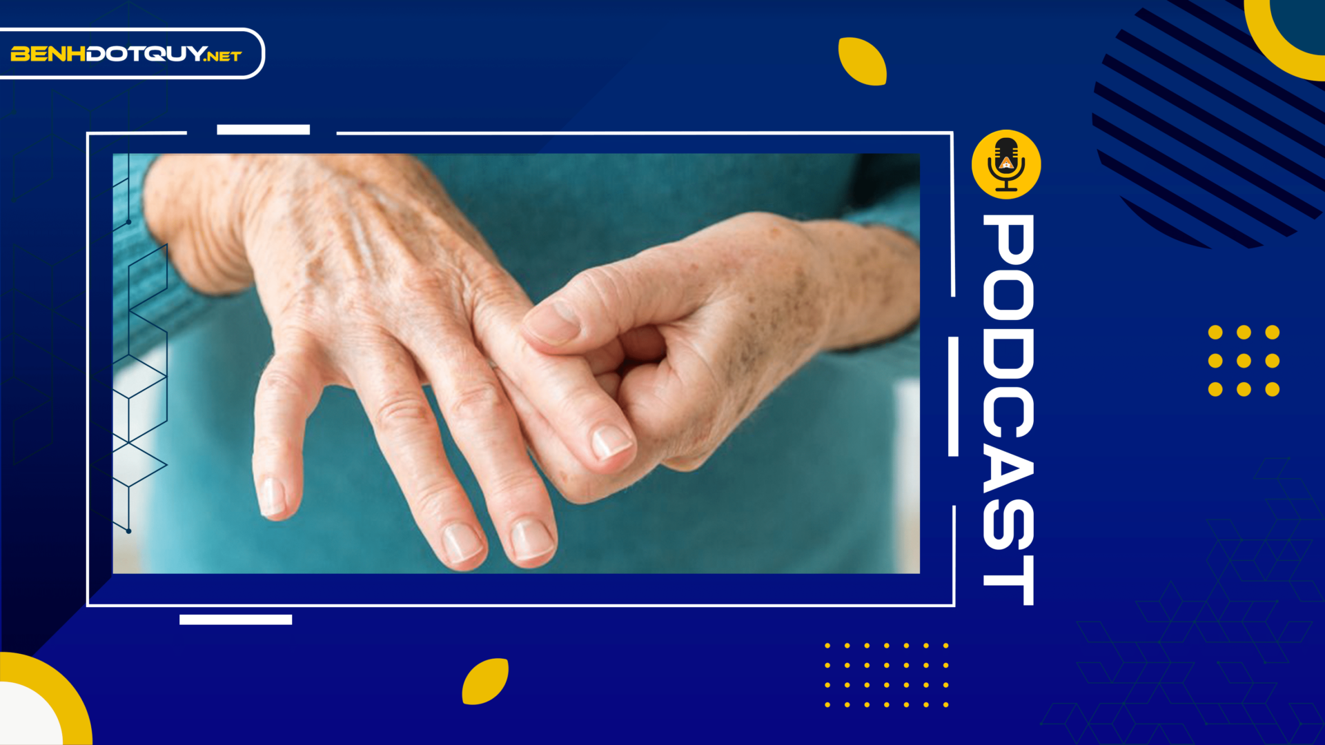 Tê tay – coi chừng đột quỵ