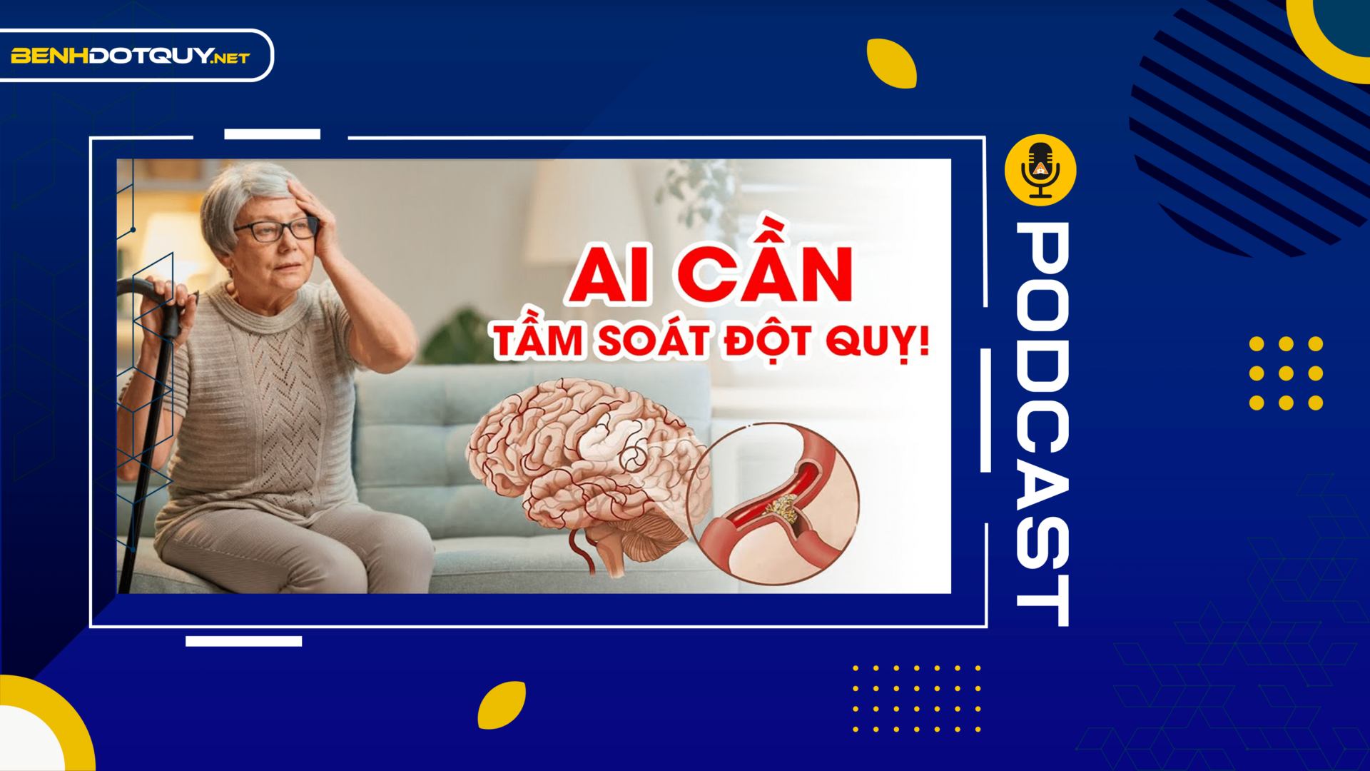 Những người nên tầm soát đột quỵ