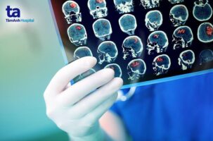 Bất kỳ ai cũng có thể bị đột quỵ, vì vậy nếu có các yếu tố nguy cơ đi kèm nên tầm soát đột quỵ càng sớm càng tốt