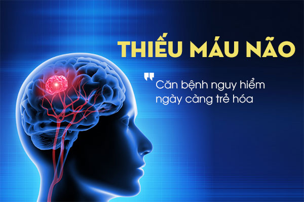 4 thói quen hàng ngày gây thiếu máu não trầm trọng