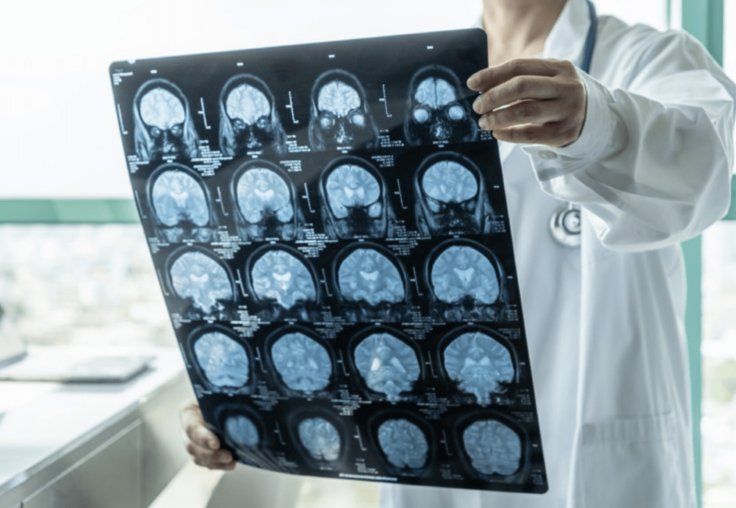 Các phương pháp chẩn đoán hình ảnh giúp bác sĩ xác định vị trí chảy máu