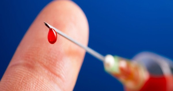 Có nên chích kim đầu ngón tay khi bị đột quỵ?