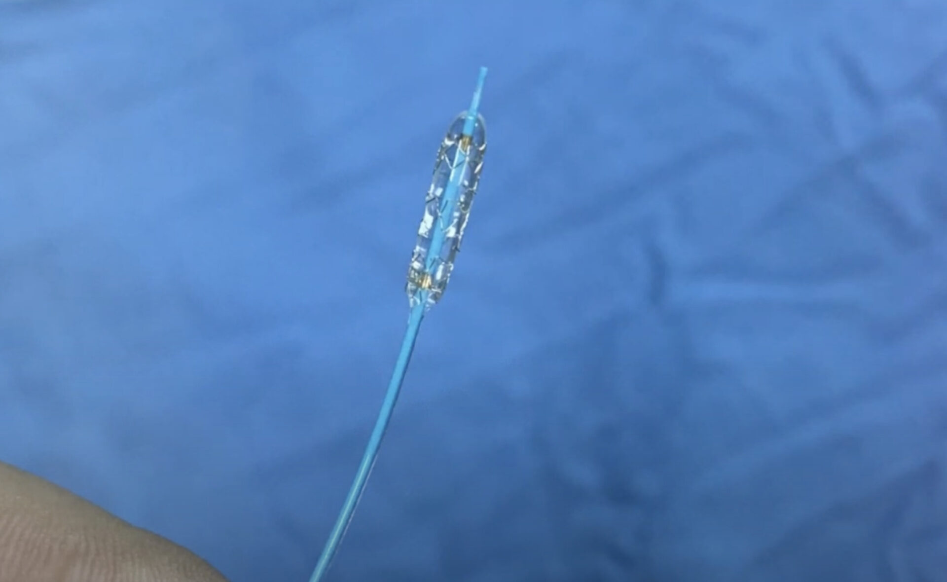 Hậu đặt stent mạch máu, những điều bệnh nhân cần biết!