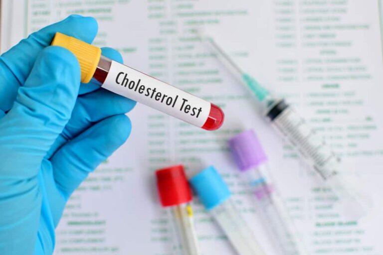 Những điều cần biết về kiểm tra cholesterol tại nhà