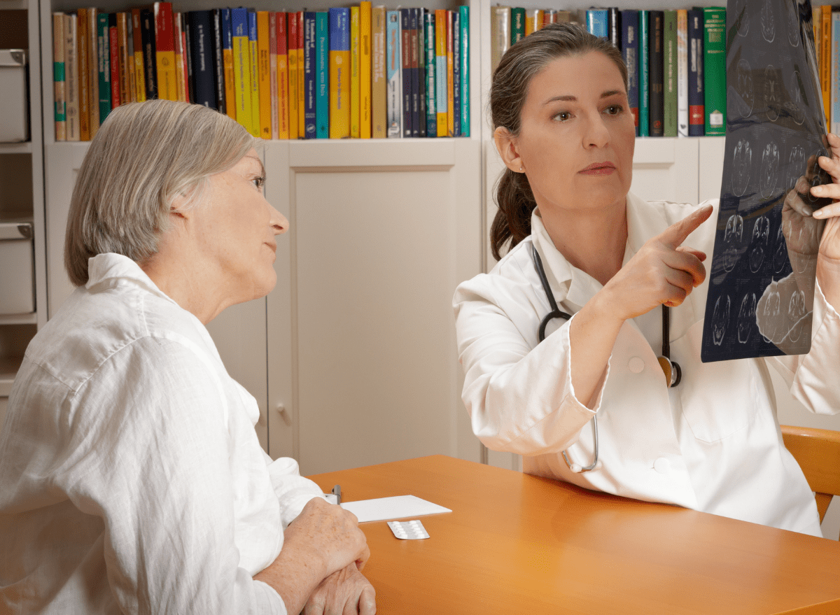 Cholesterol cao làm tăng nguy cơ mắc đột quỵ sau tuổi 50