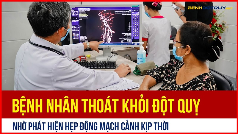 Bệnh nhân thoát khỏi đột quỵ nhờ phát hiện hẹp động mạch cảnh kịp thời